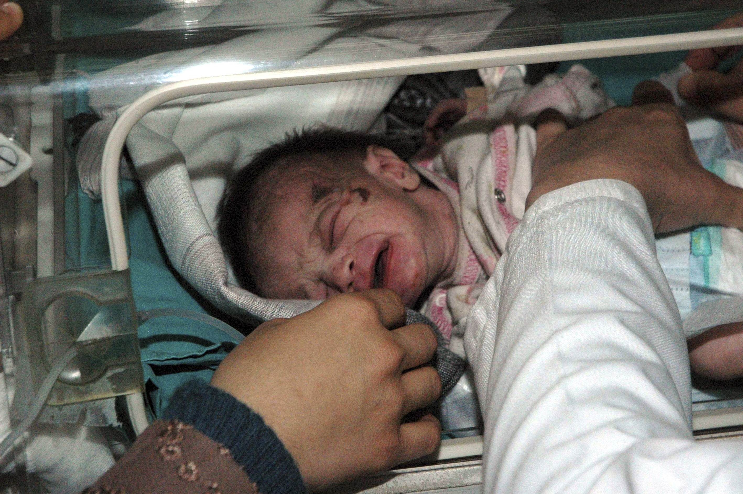 Το μωρό που σώθηκε σαν από θαύμα διακομίστηκε σε νοσοκομείο στην Άγκυρα.
