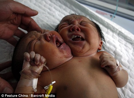 Φωτογραφία από τη Daily Mail