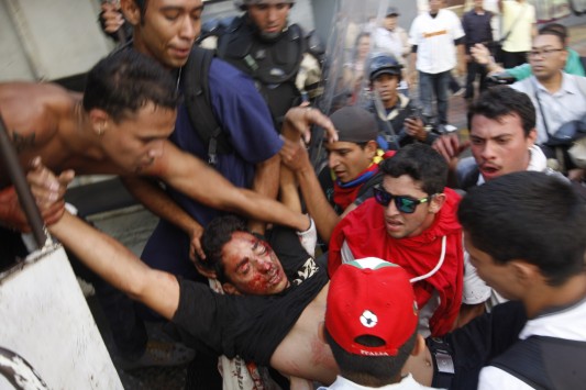 Αποτέλεσμα εικόνας για νεκροι Βενεζουέλας