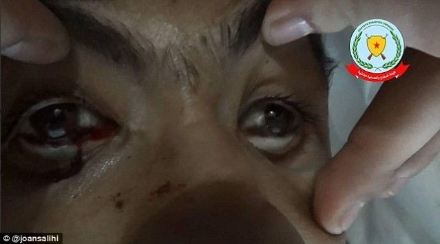 Νέο μακελειό στο Κομπάνι! - Οι τζιχαντιστές επιτίθενται με χημικά όπλα - Δεκάδες θύματα