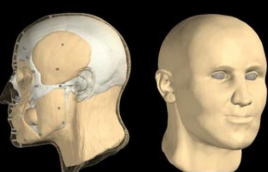 Αμφίπολη: Θα δούμε το πρόσωπο του νεκρού – Οι επιστήμονες μπορούν να αναδείξουν όλα τα χαρακτηριστικά του 