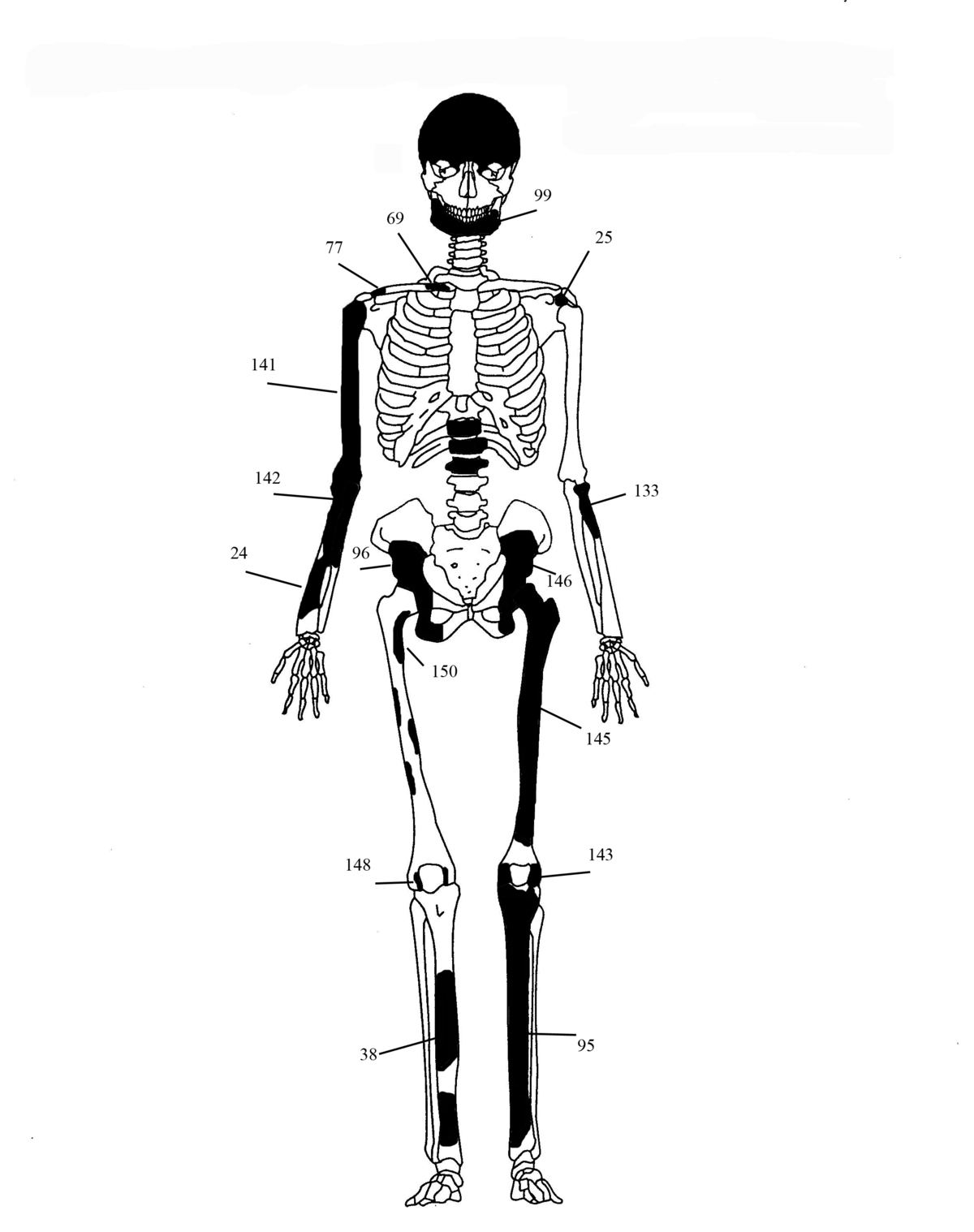 Εικόνα 1: Ενδεικτική εκπροσώπηση οστών Ατόμου 1