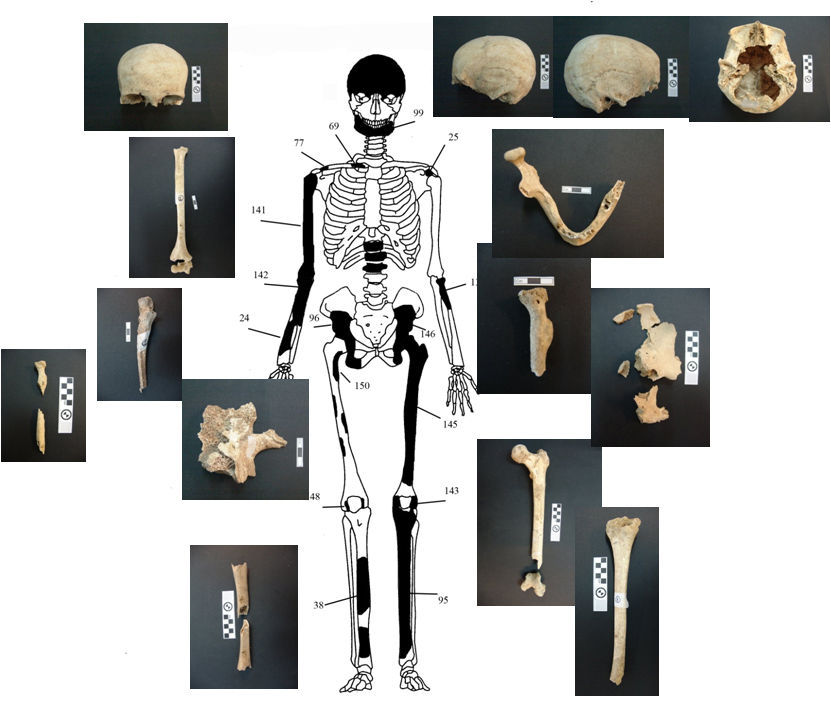 Εικόνα 2: Ενδεικτική εκπροσώπηση οστών Ατόμου 1 με φωτογραφίες οστών