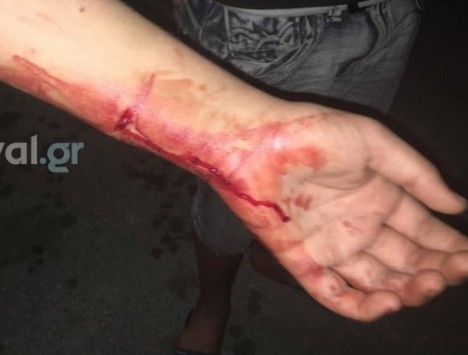 Θεσσαλονίκη: Αίμα, δάκρυα και δολοφονικά χτυπήματα με μαχαίρι και σανίδα - Άγρια επεισόδια μεταξύ μεταναστών (Βίντεο)!