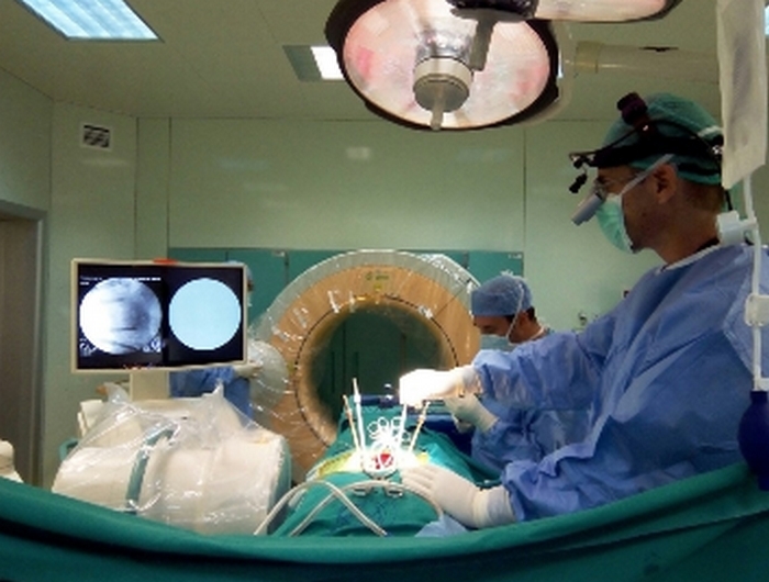 Εικόνα κατά τη διάρκεια χειρουργείου ασθενούς με πολλαπλά οστεοπορωτικά κατάγματα της σπονδυλικής στήλης ο οποίος υποβλήθηκε σε κυφοπλαστική με τη χρήση του O-arm