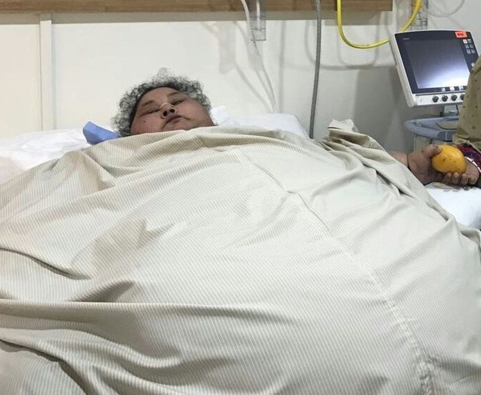 Η γυναίκα πριν την εγχείρηση / Φωτογραφία από bbc.co.uk