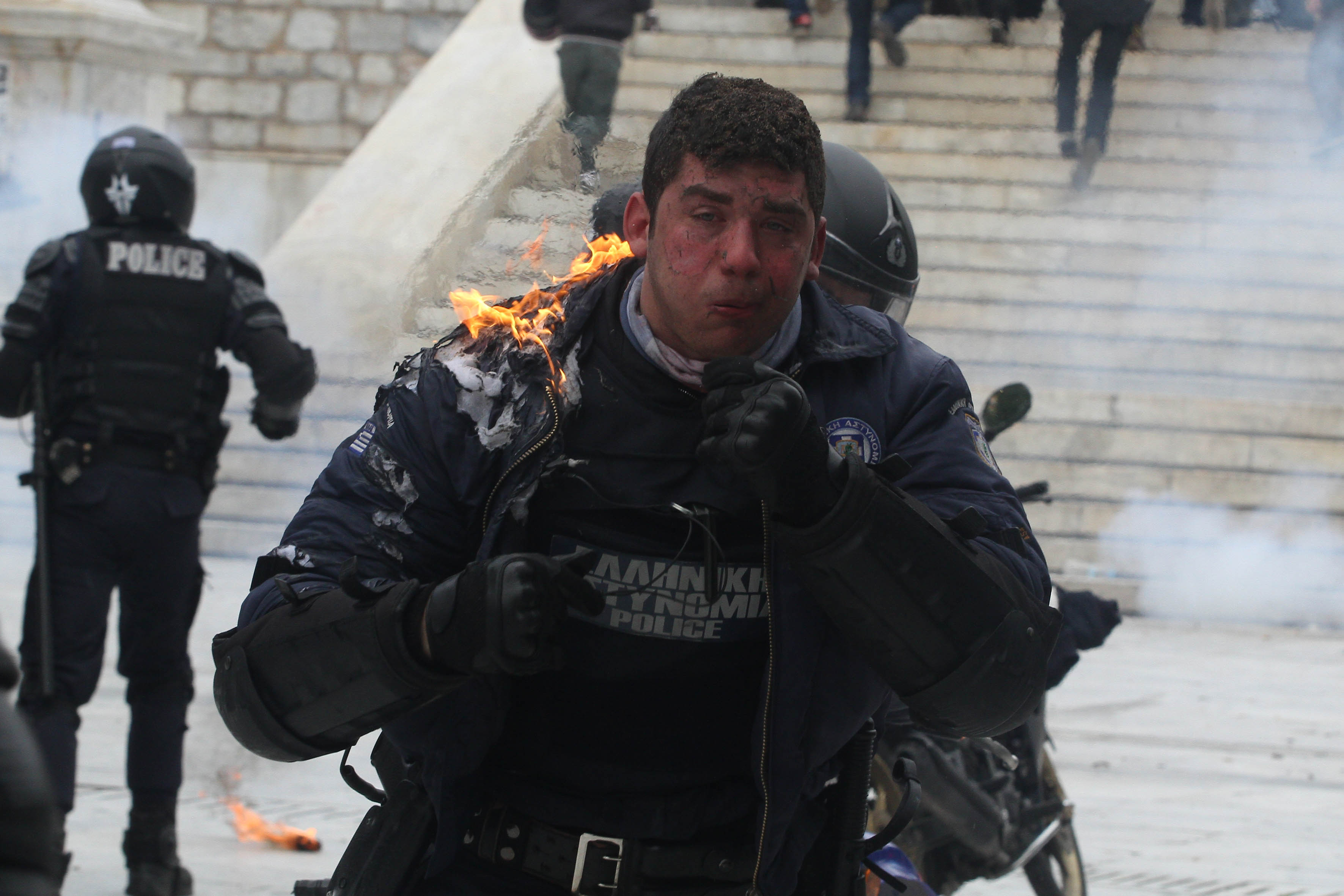 Ο αστυνομικός λίγο αφού δέχτηκε τη βόμβα μολότωφ - ΦΩΤΟ EUROKINISSI