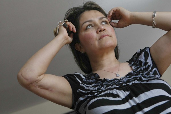 Αυτή είναι η γυναίκα που η πλαστική στο στήθος της έσωσε τη ζωή!