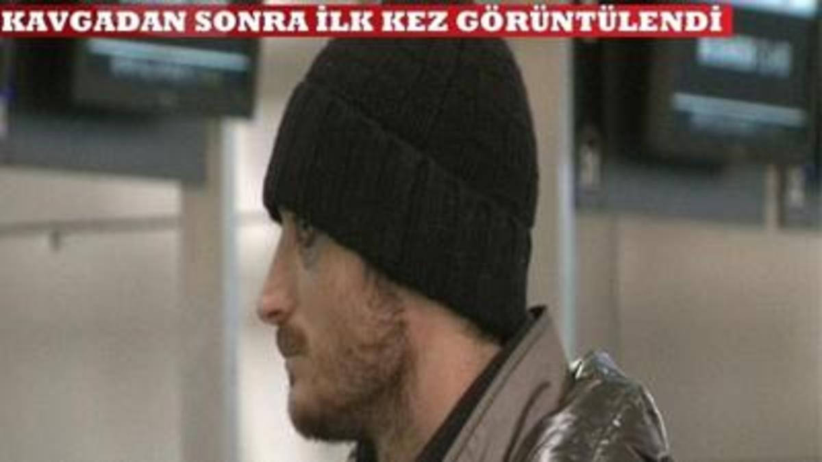 Το μαυρισμένο μάτι του Ριέρα! | Newsit.gr Το μαυρισμένο μάτι του Ριέρα! | Newsit.gr
