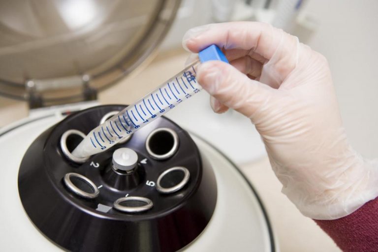 Ουρές στο ΕΣΥ για μία εξέταση Aids! | Newsit.gr Ουρές στο ΕΣΥ για μία εξέταση Aids! | Newsit.gr