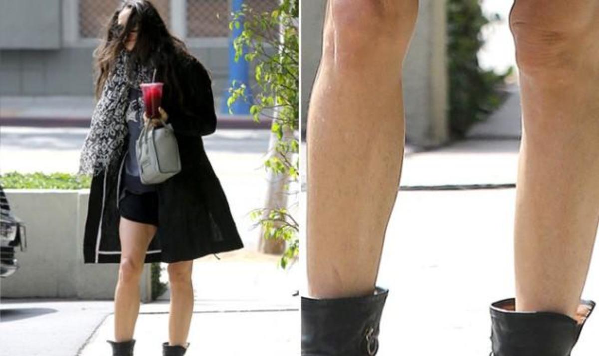 Oops! H Demi Moore ξέχασε να ξυρίσει τα πόδια της και οι παπαράτσι το…κατάλαβαν! | Newsit.gr Oops! H Demi Moore ξέχασε να ξυρίσει τα πόδια της και οι παπαράτσι το…κατάλαβαν! | Newsit.gr