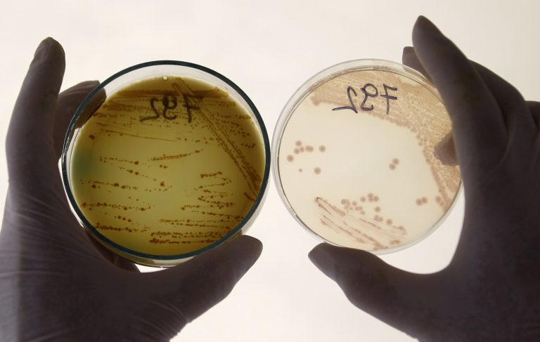 Ο τρόμος του E.coli έφτασε στην Ελλάδα μέσω Lidl! | Newsit.gr Ο τρόμος του E.coli έφτασε στην Ελλάδα μέσω Lidl! | Newsit.gr