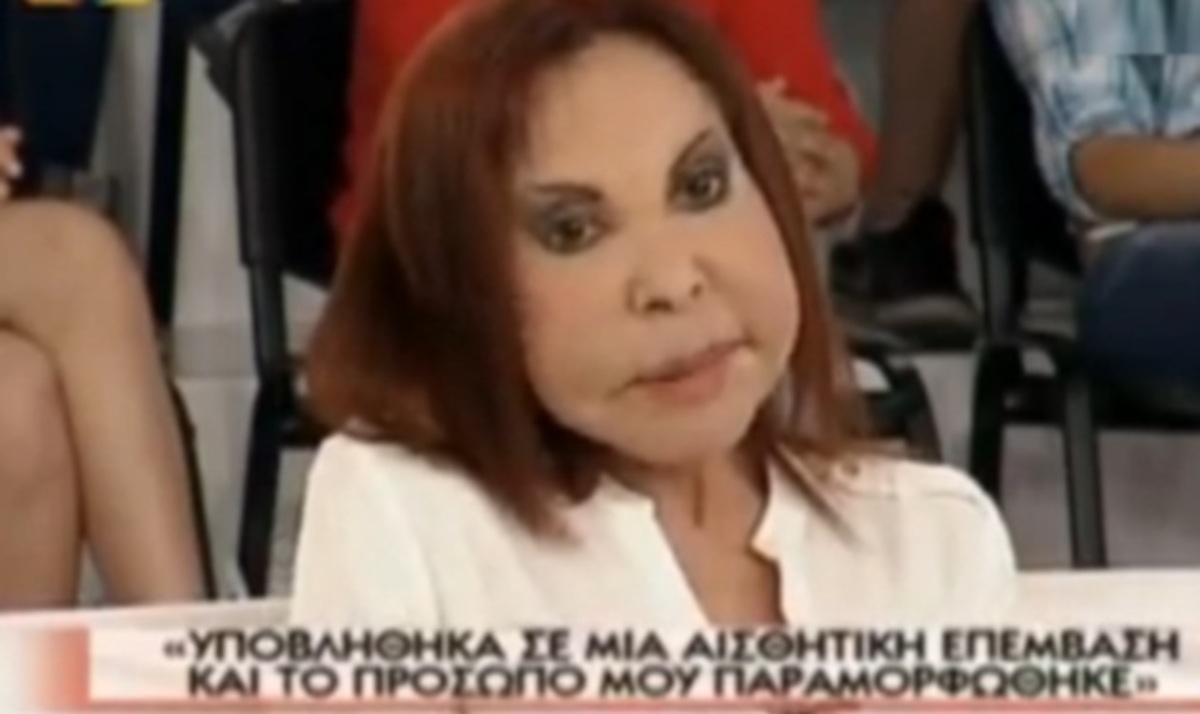 Τραγουδίστρια που παραμορφώθηκε από πλαστικές στην Τατιάνα: “Η φιλαρέσκειά μου με κατέστρεψε” | Newsit.gr Τραγουδίστρια που παραμορφώθηκε από πλαστικές στην Τατιάνα: “Η φιλαρέσκειά μου με κατέστρεψε” | Newsit.gr