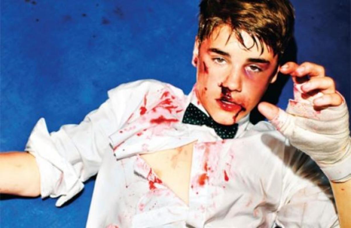 Τι συνέβη στον Justin Bieber; | Newsit.gr Τι συνέβη στον Justin Bieber; | Newsit.gr