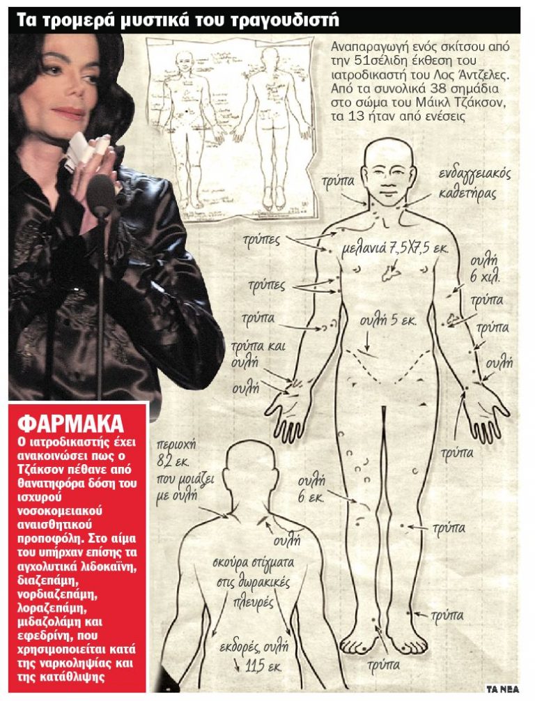 Το σκίτσο στην έκθεση του ιατροδικαστή του M.Jackson που προκαλεί σοκ! | Newsit.gr Το σκίτσο στην έκθεση του ιατροδικαστή του M.Jackson που προκαλεί σοκ! | Newsit.gr