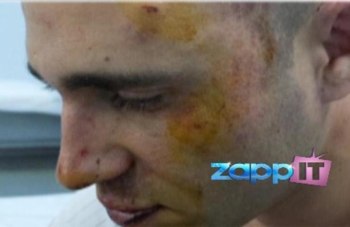 Δείτε φωτογραφίες από τον άγριο ξυλοδαρμό που δέχτηκε ο Κώστας Μπογδάνος! Tι λέει ο ΣΚΑΙ για το γεγονός | Newsit.gr Δείτε φωτογραφίες από τον άγριο ξυλοδαρμό που δέχτηκε ο Κώστας Μπογδάνος! Tι λέει ο ΣΚΑΙ για το γεγονός | Newsit.gr