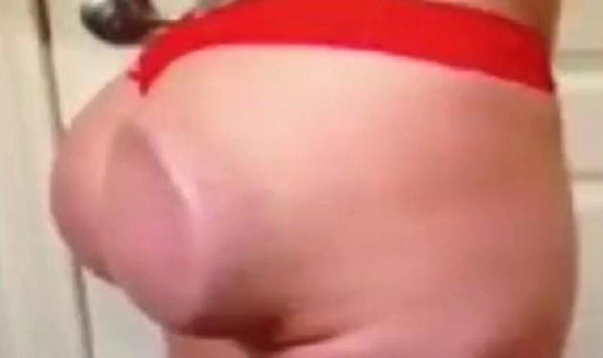 Όταν τα εμφυτεύματα οπισθίων μπαίνουν ανάποδα! Συγκλονιστικό βίντεο | Newsit.gr Όταν τα εμφυτεύματα οπισθίων μπαίνουν ανάποδα! Συγκλονιστικό βίντεο | Newsit.gr