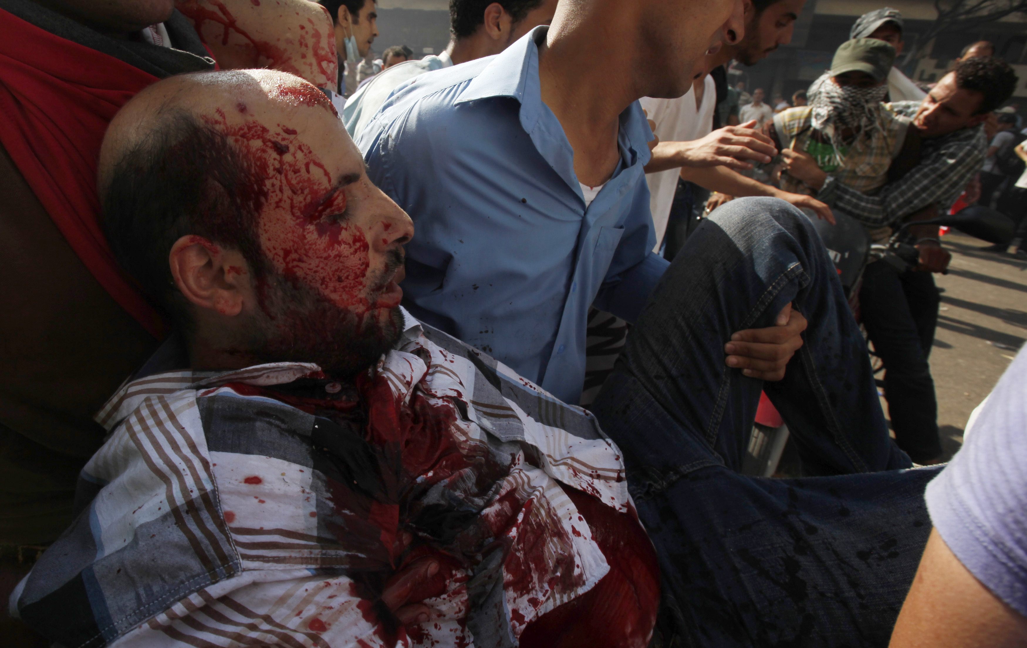 Ενας τραυματισμένος διαδηλωτής μεταφέρεται σε αυτοσχέδιο νοσοκομείο ΦΩΤΟ REUTERS