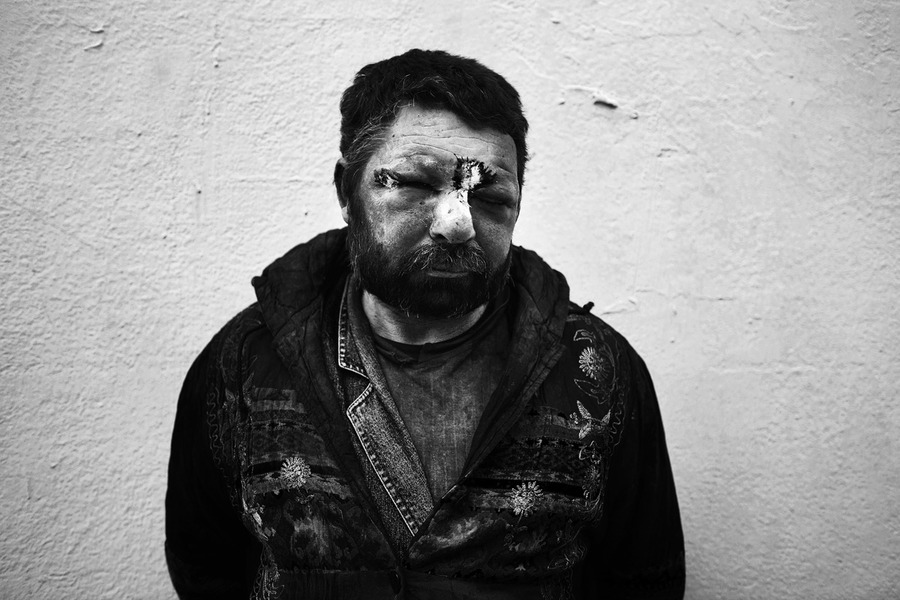Άνδρας που έπεσε θύμα επίθεσης στο κέντρο της Αθήνας
