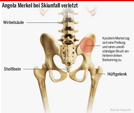 Εδώ έχει χτυπήσει η Άνγκελα Μέρκελ, σύμφωνα με την εφημερίδα Bild