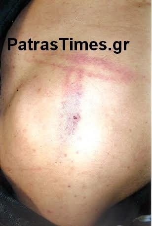 ΦΩΤΟ από το PatrasTimes
