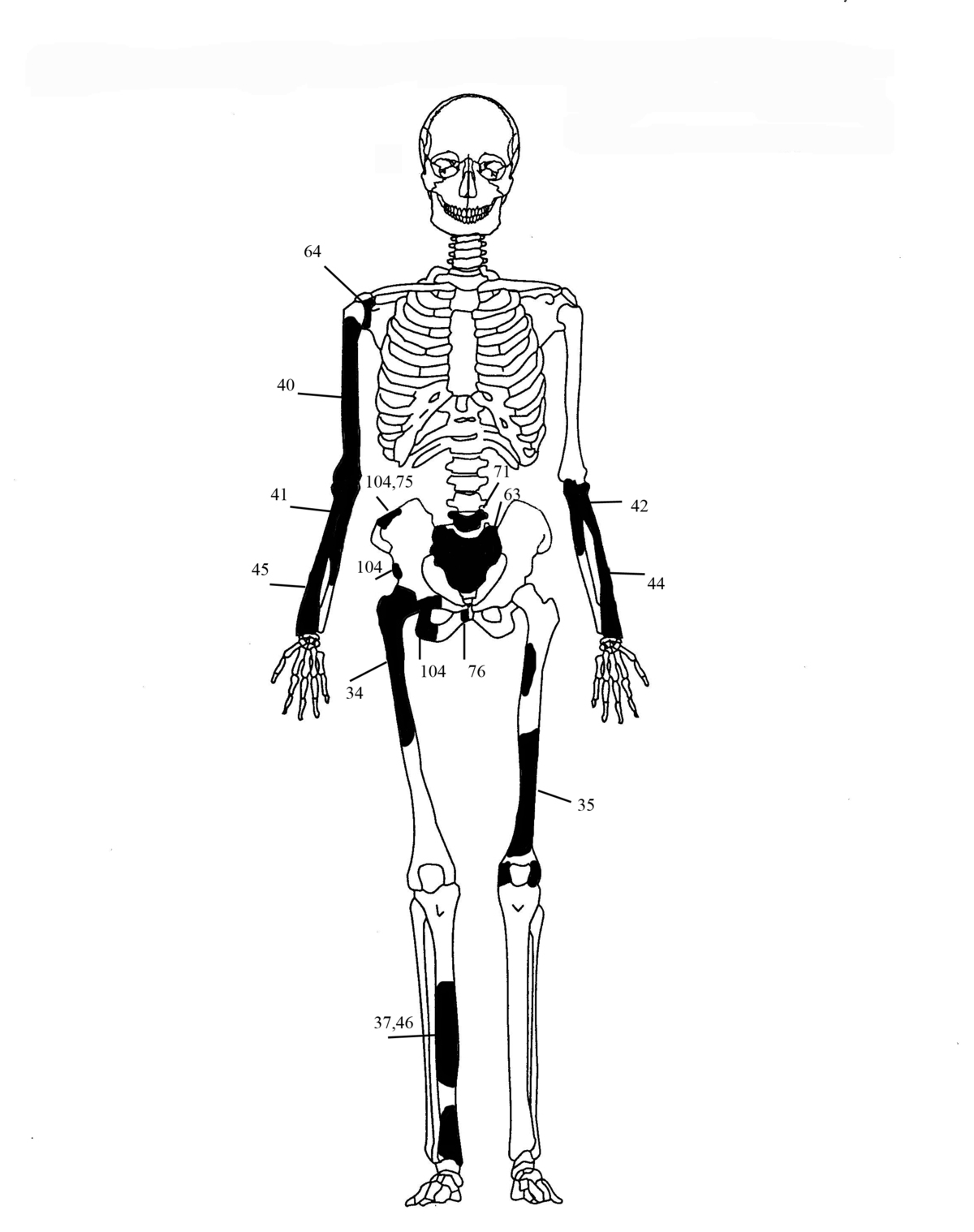 Εικόνα 5: Ενδεικτική εκπροσώπηση οστών Ατόμου 3