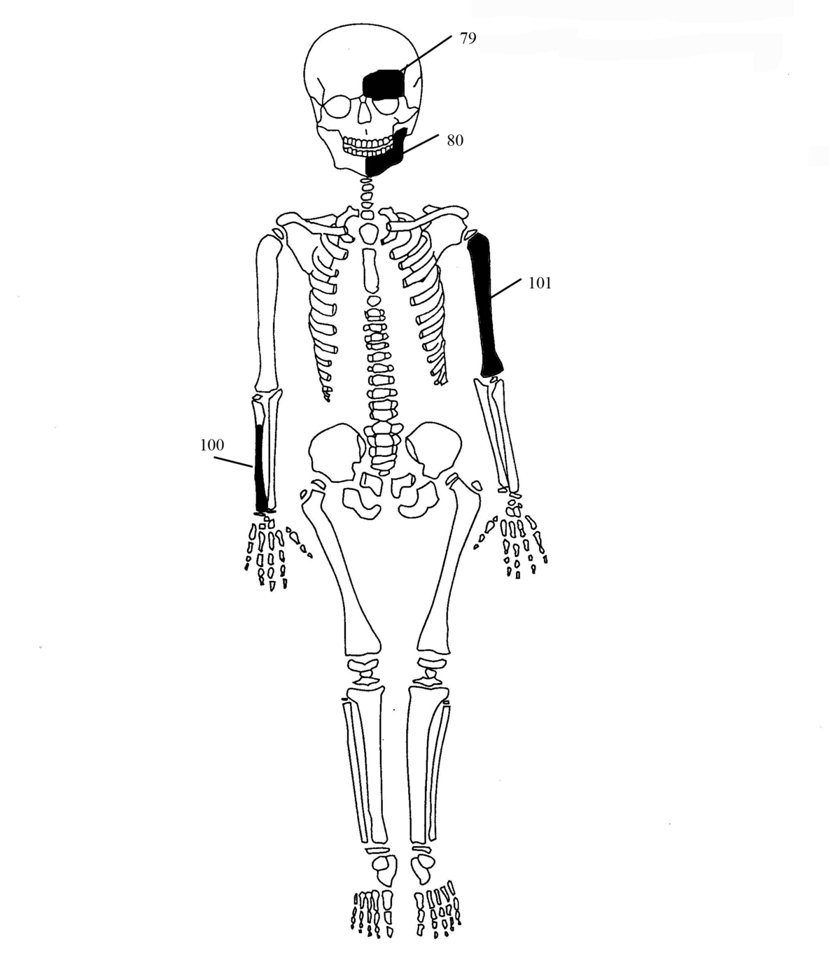Εικόνα 7: Ενδεικτική εκπροσώπηση οστών Ατόμου 4
