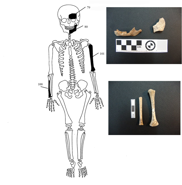 Εικόνα 8: Ενδεικτική εκπροσώπηση οστών Ατόμου 4 με φωτογραφίες οστών