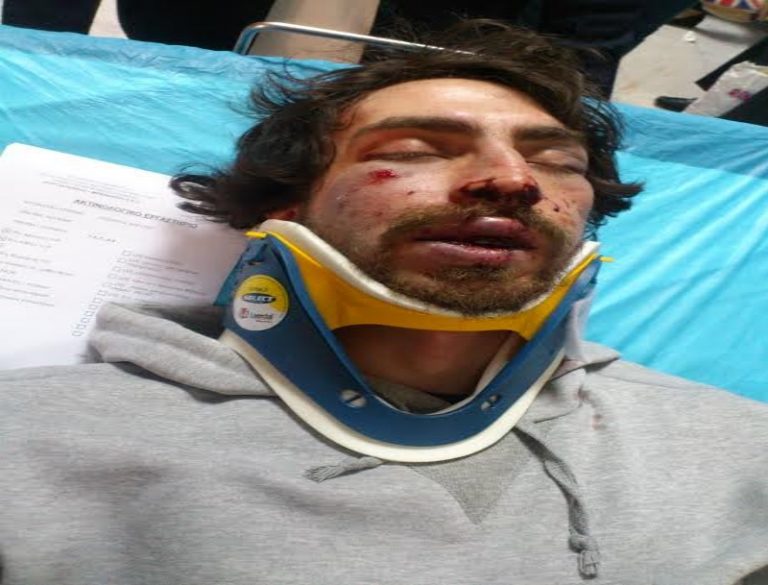 Τάγμα Χρυσαυγιτών ξυλοκόπησε μέχρι λιποθυμίας 24χρονο φοιτητή – Δεν μπορούσε ούτε να καταθέσει – Σοκάρουν οι φωτογραφίες