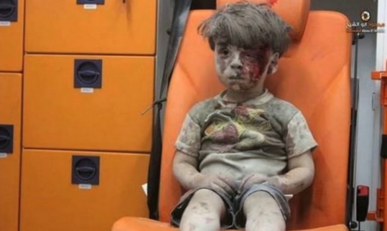 Πώς είναι σήμερα το αγόρι – σύμβολο των βομβαρδισμών στο Χαλέπι [vid]