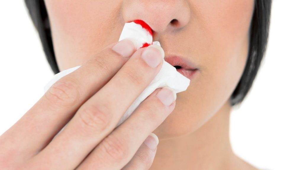 Αίμα από την μύτη: Πώς σταματάει – Τα λάθη που κάνετε χωρίς να το ξέρετε