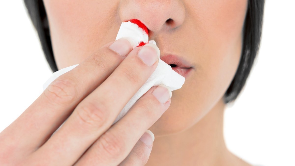 Αίμα από την μύτη: Πώς σταματάει – Τα λάθη που κάνετε χωρίς να το ξέρετε