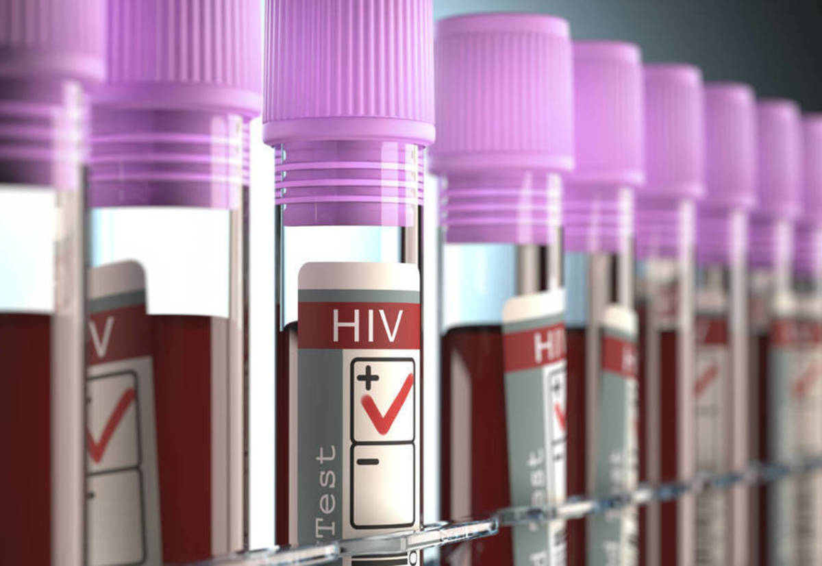 AIDS: Πρωτοφανή αποτελέσματα από νέα θεραπεία – Η περίπτωση 44χρονου Βρετανού