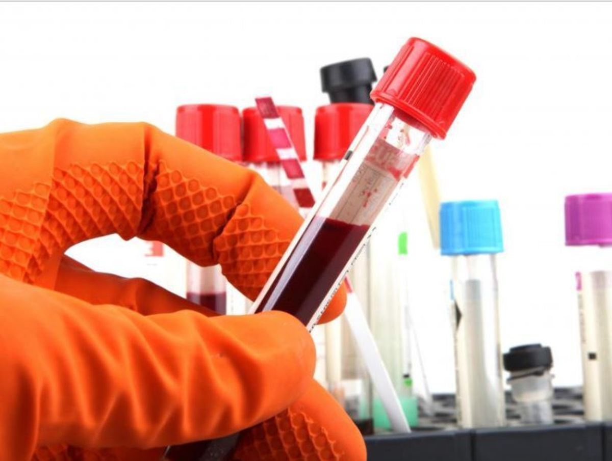 Αιματοκρίτης: Τι σημαίνουν τα όρια στην εξέταση αίματος – Ποιες παθήσεις υποδεικνύουν