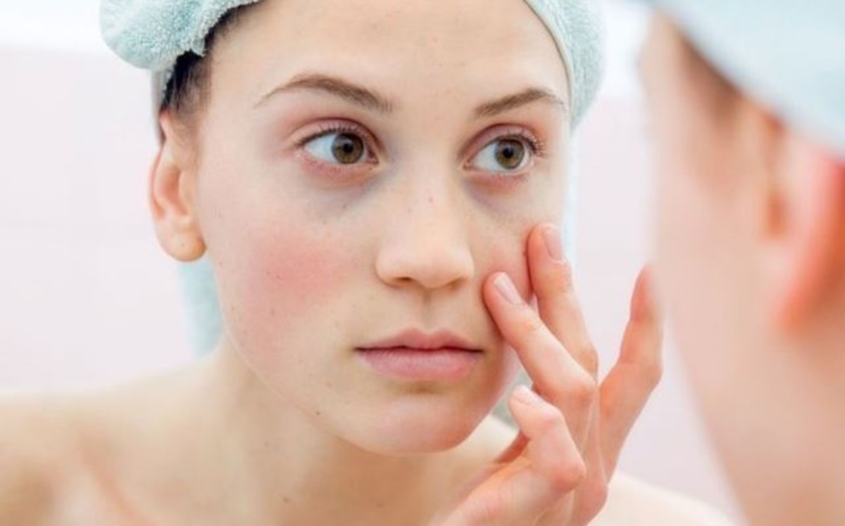 Σακούλες κάτω από τα μάτια: Ποιες φυσικές ουσίες τις μειώνουν αισθητά