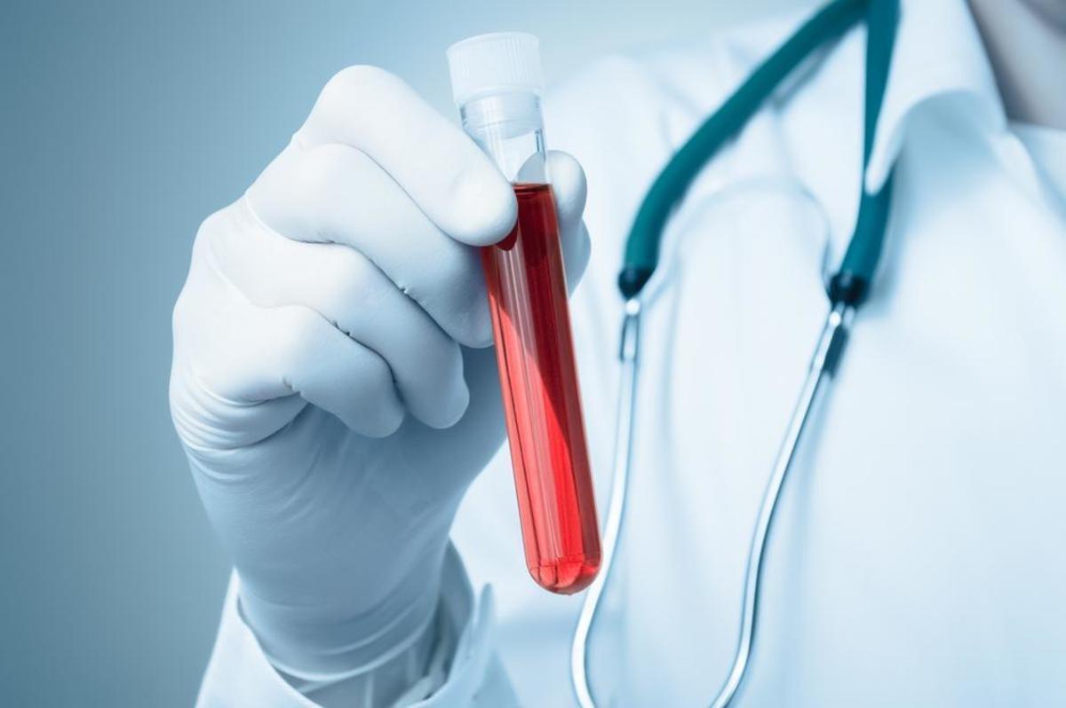 Πάρκινσον: Τεστ αίματος «ανιχνεύει» τα πρώιμα συμπτώματα
