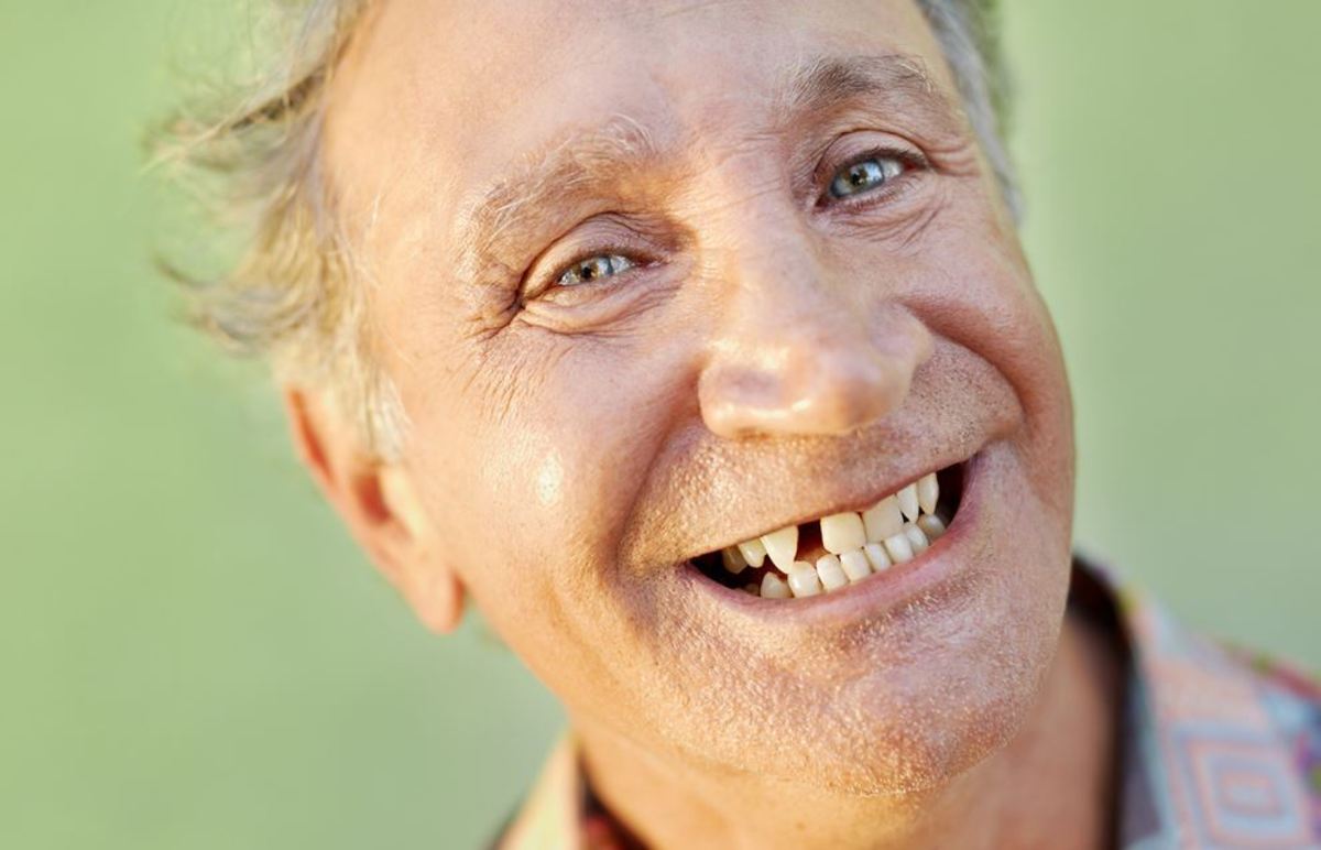 Ένδειξη για άνοια το πόσα δόντια σας έχουν μείνει μετά από κάποια ηλικία