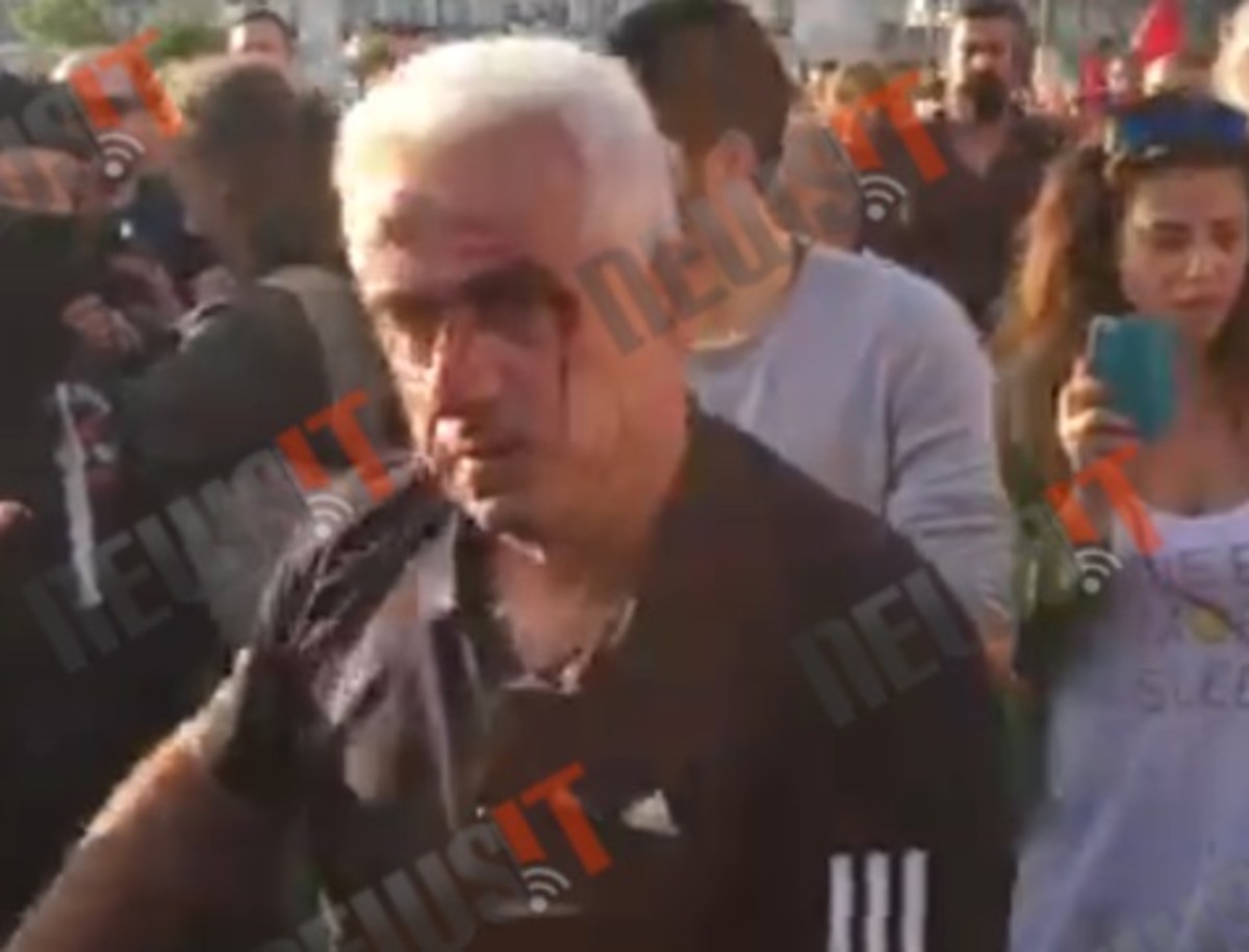 Ξυλοδαρμός συνδικαλιστή στο Σύνταγμα