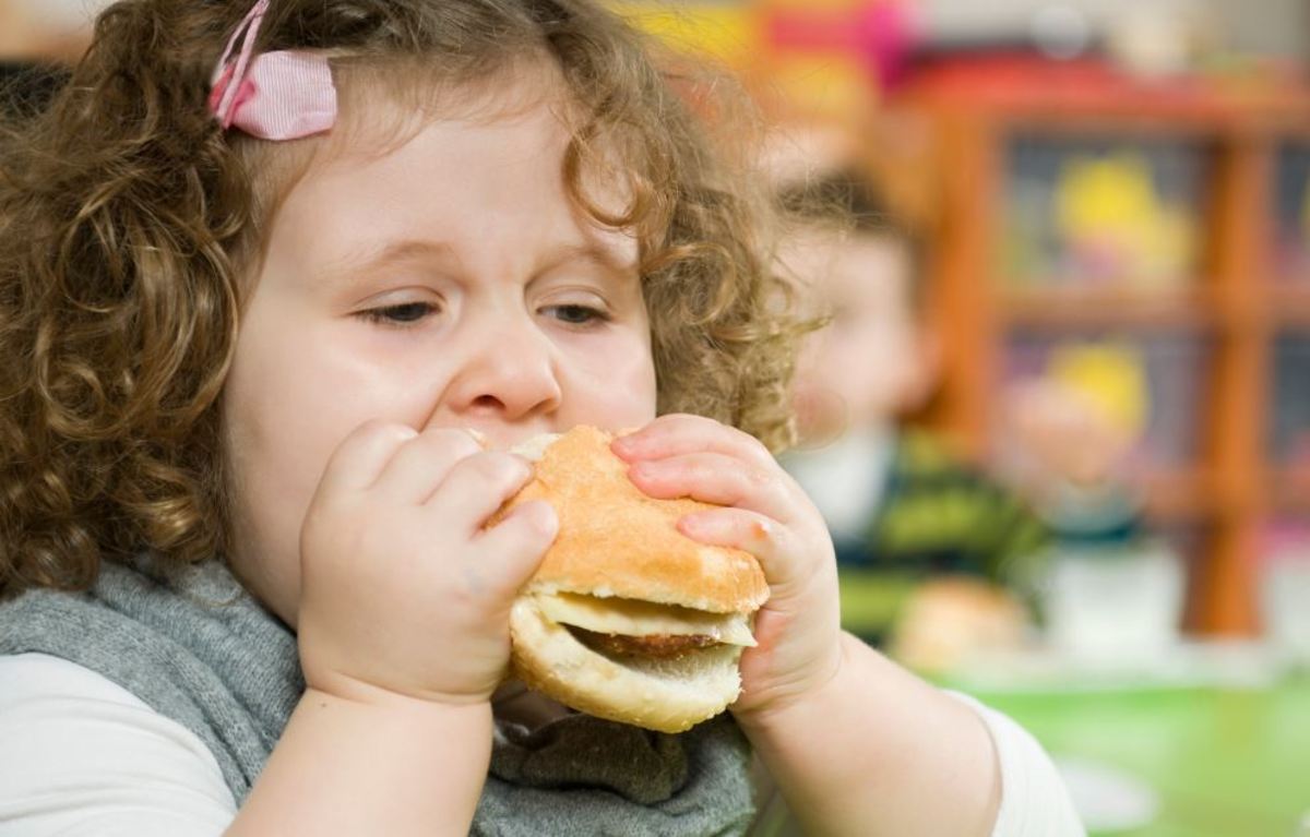 Κληρονομική κατά 40% η παιδική παχυσαρκία λένε οι επιστήμονες – Τι εννοούν