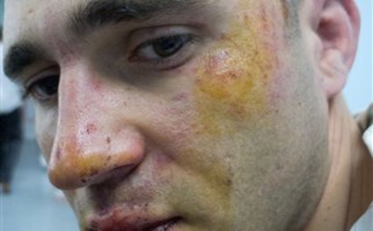 ΦΩΤΟ ΑΠΟ ΣΚΑΙ