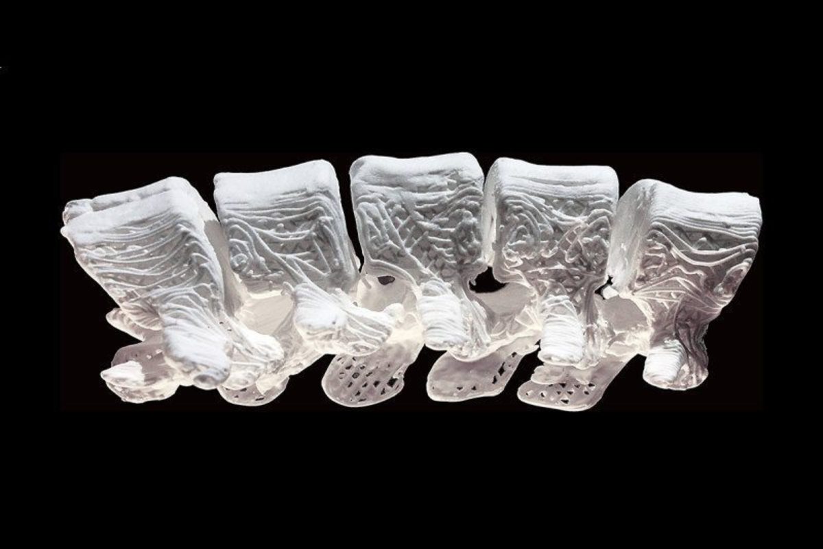 Τα συνθετικά οστά από 3D εκτυπωτή φέρνουν επανάσταση στην αποκατάσταση καταγμάτων [vid]