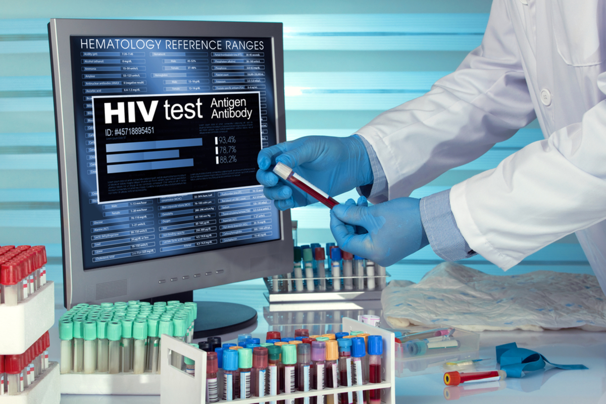 AIDS: Νέο τεστ ανιχνεύει πρόωρα τον ιό HIV – Τι λένε, πλέον, οι επιστήμονες