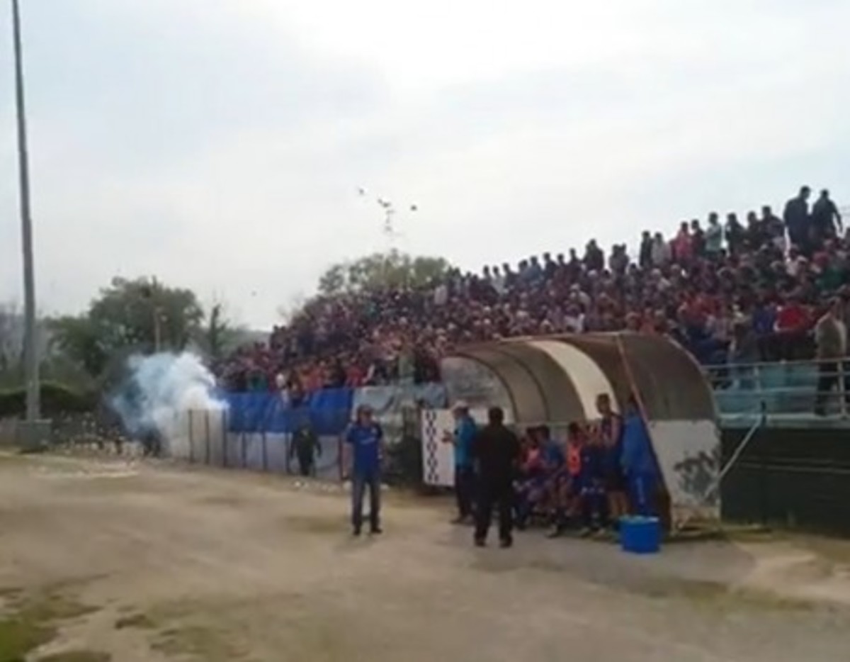 Ακρωτηριασμός φιλάθλου σε γήπεδο