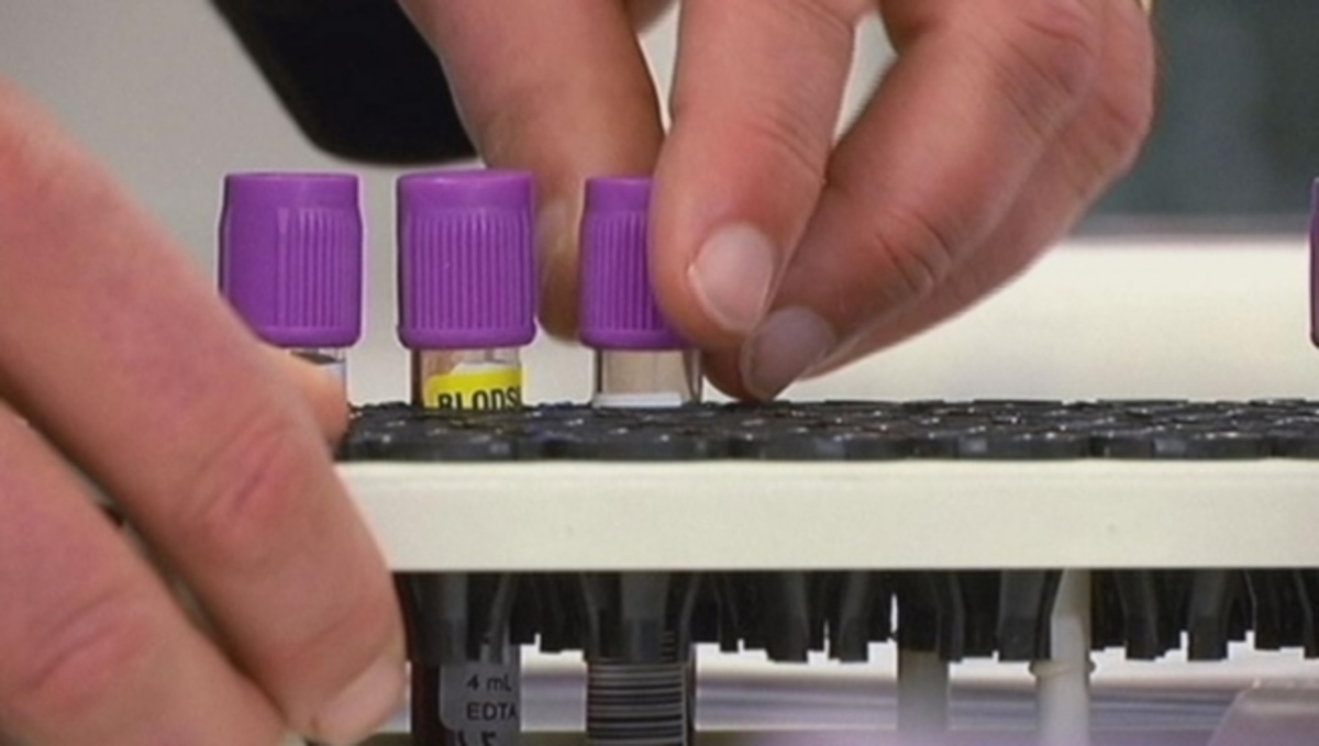 Νέο τεστ αίματος εντοπίζει καλύτερα τον καρκίνο του προστάτη από το PSA