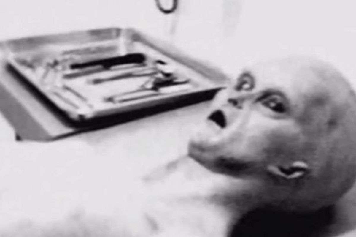 Ντοκουμέντο από την αυτοψία εξωγήινου στο Roswell: Η πραγματική φωτογραφία;