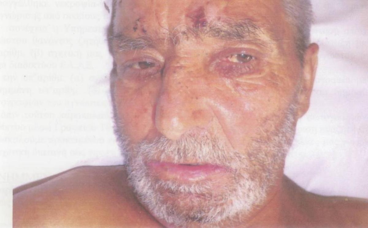 Ο άνδρας όταν νοσηλευόταν - ΦΩΤΟ ΕΛ.ΑΣ.