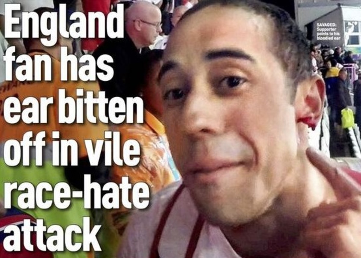 Mundial 2014: Βαρβαρότητα! Άγγλος έκοψε το αυτί συμπατριώτη του (ΦΩΤΟ)