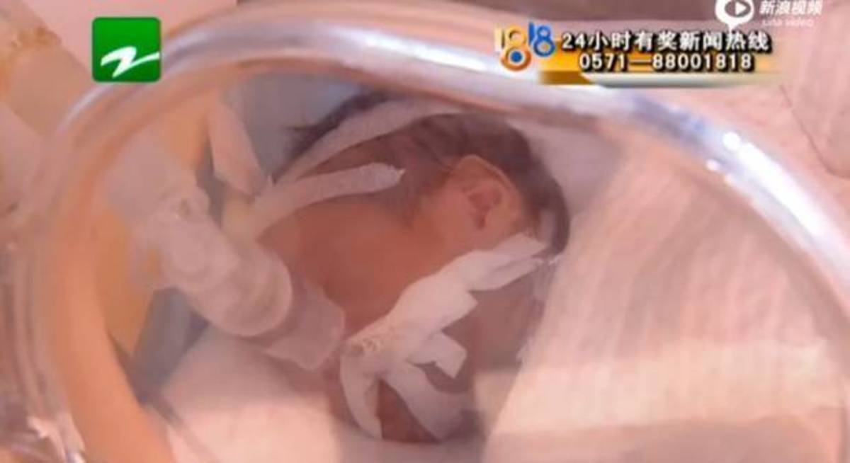 Μωράκι ξύπνησε πριν το αποτεφρώσουν – Επιβίωσε στο ψυγείο νεκροτομείου 15 ώρες