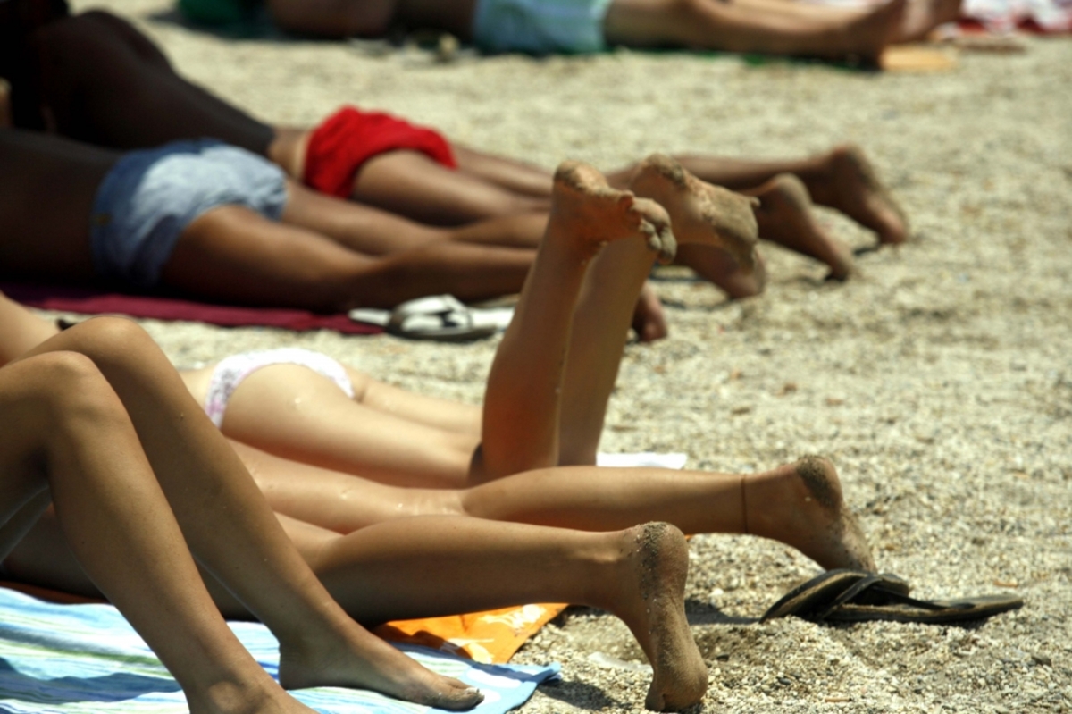 Ηλιακό Έγκαυμα – Πώς θα ανακουφιστείτε από τον πόνο χωρίς φάρμακα