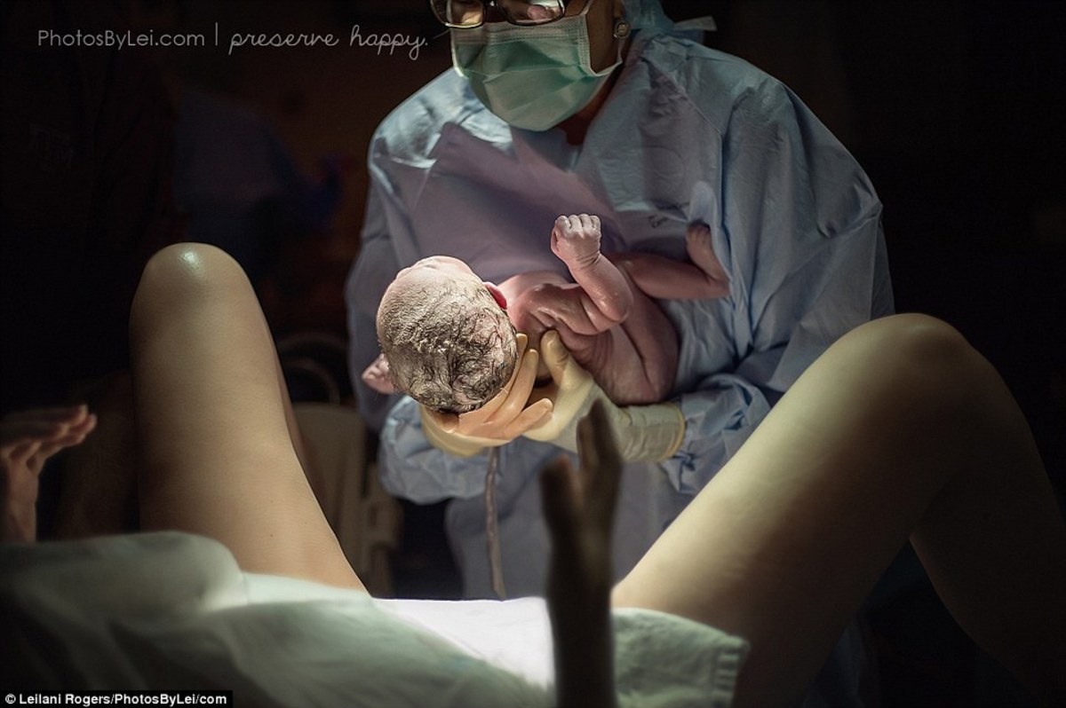 Το θαύμα της γέννας – Συγκλονιστικές φωτογραφίες πριν και μετά τον τοκετό